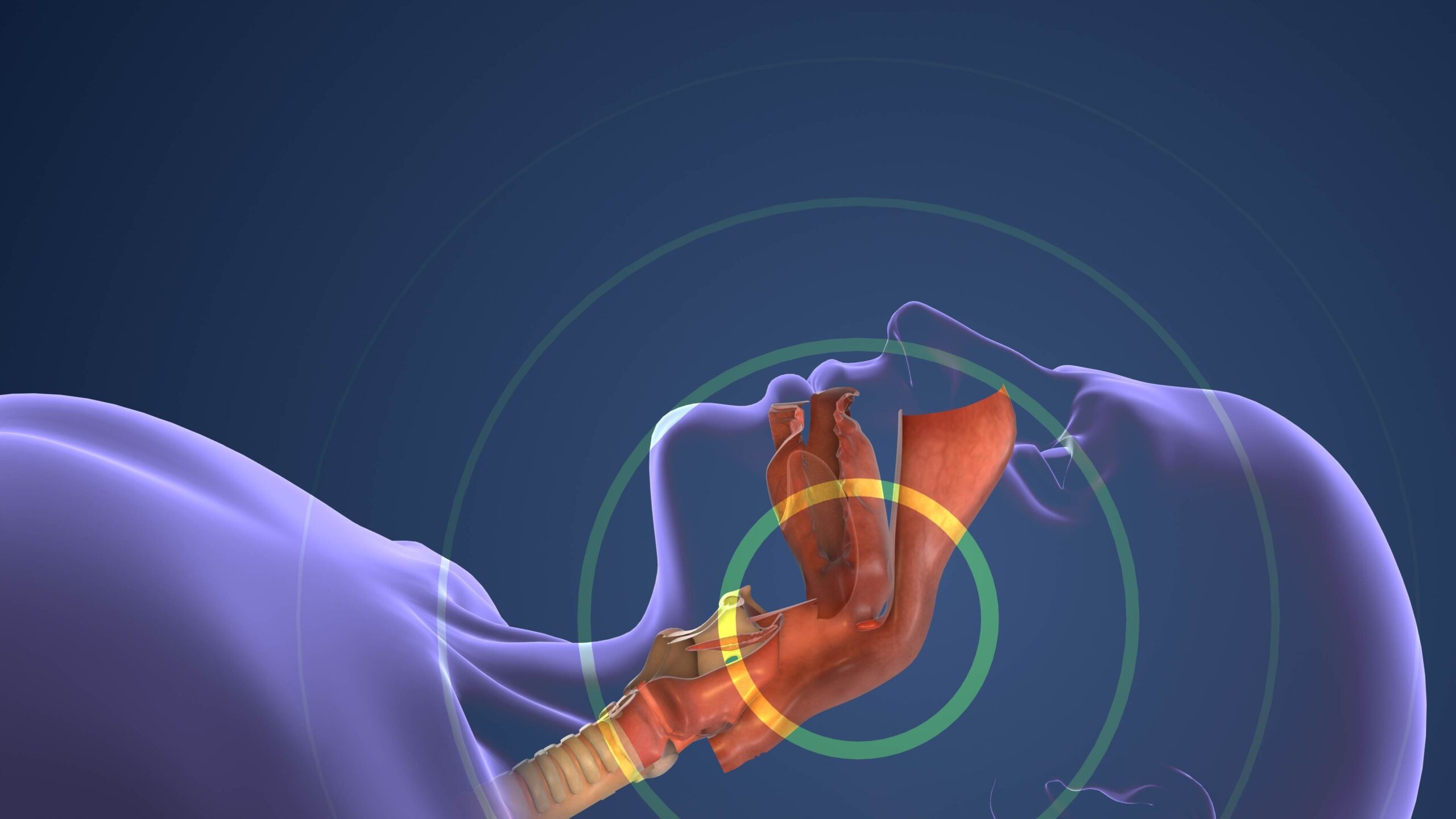 Sleep Disordered Breathing