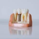 Prosthodontist Dubai