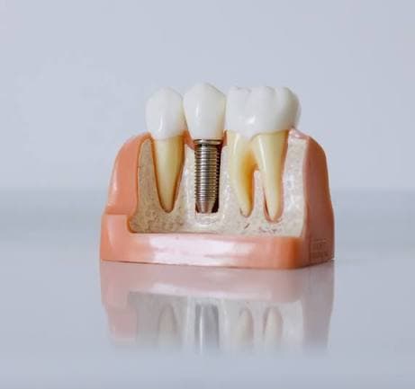 Prosthodontist Dubai