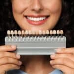 veneers in Dubai