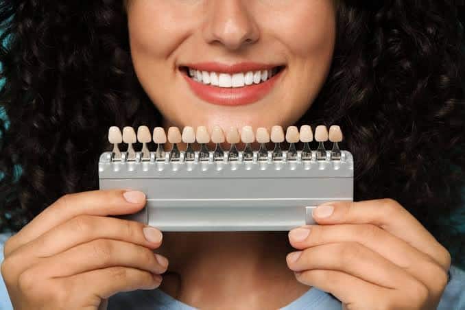 veneers in Dubai
