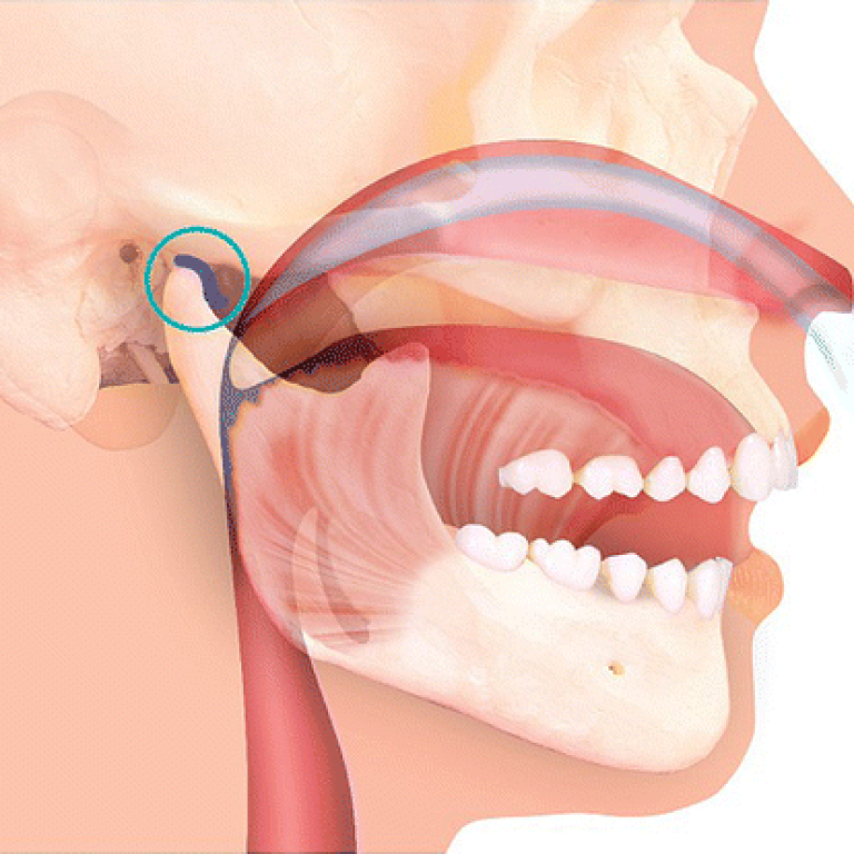 Airway-Centric Risk Assessment
