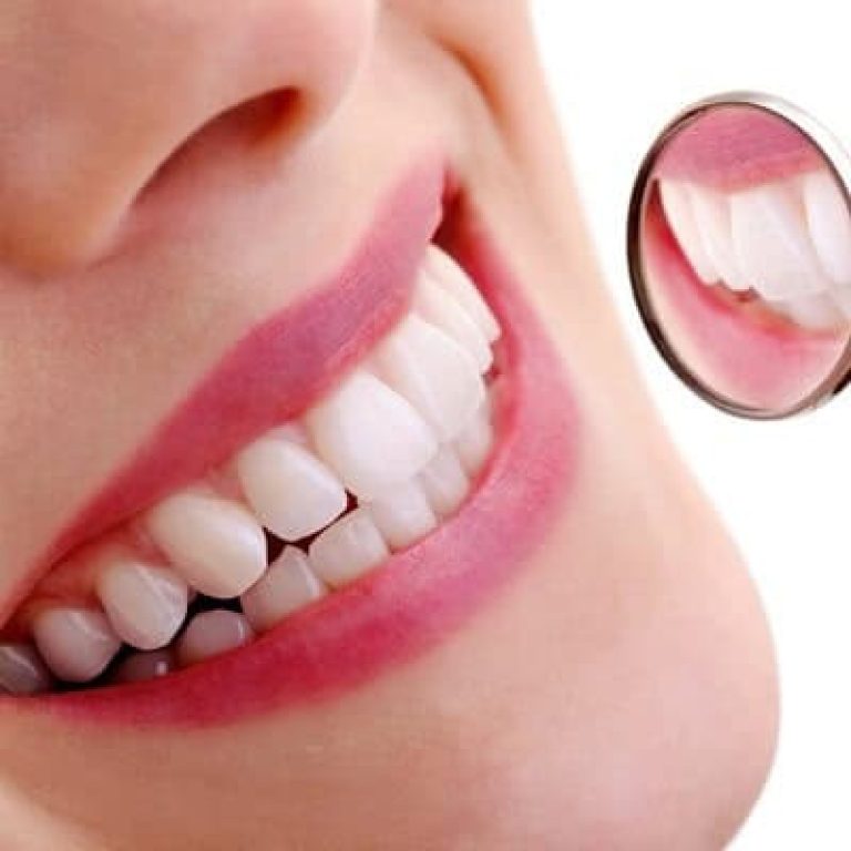 Cosmetic Dentistry in Dubai
