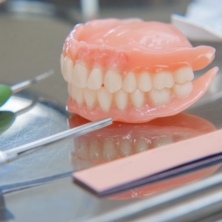 Full Mouth Rehabilitation in Dubai
