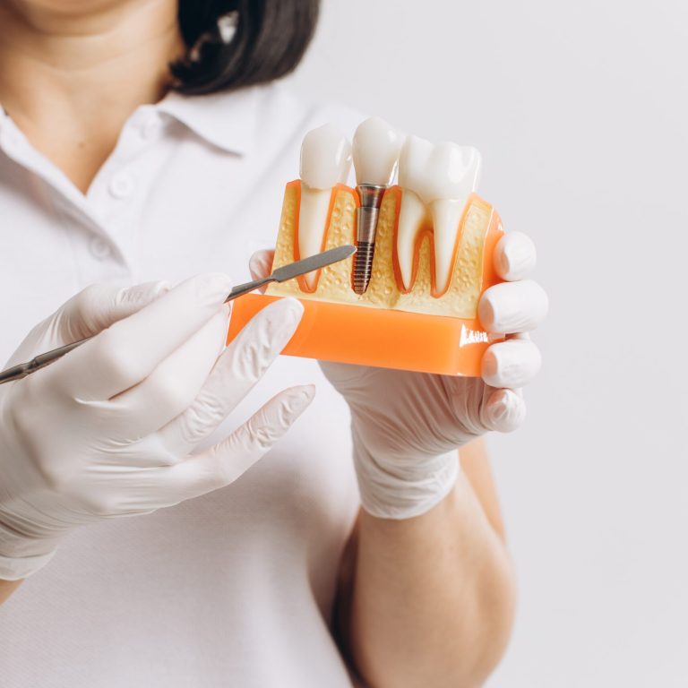 Happy,Dentist,Doctor,Woman,Showing,Mockup,Of,Implants