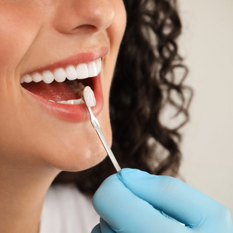 Doctor,Checking,Young,Woman's,Teeth,Color,On,Light,Grey,Background,